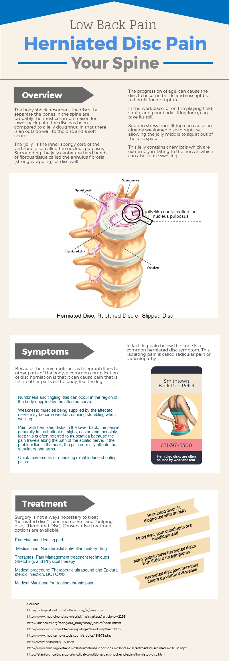 herniated disc infographic